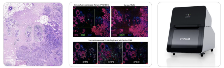 Xenium® Spatial Analyzer | BioChain Spatial Biology